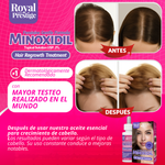 ReviGrow™ - Aceite Esencial con Minoxidil al 2% para Hombres y Mujeres